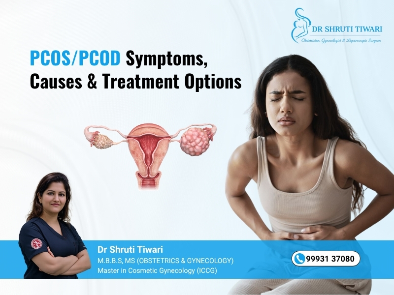 PCOS/PCOD Symptoms, Causes & Treatment Options