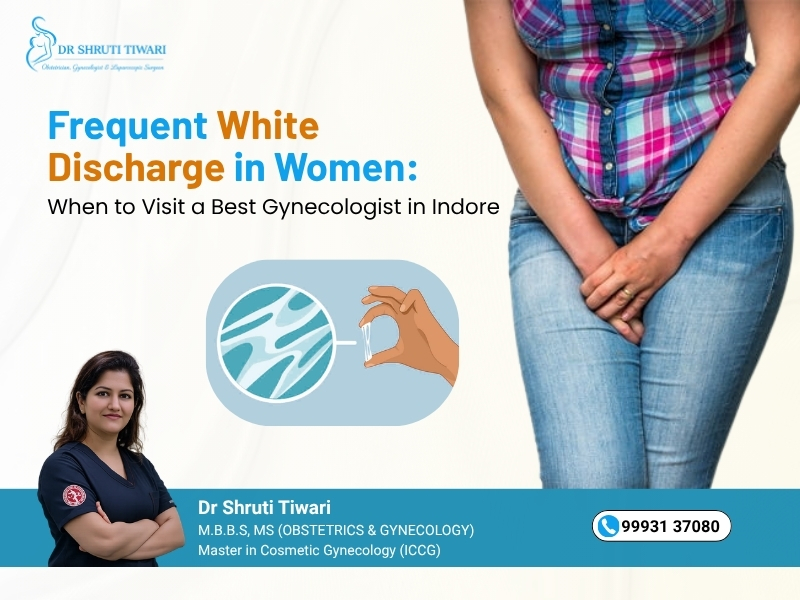 Frequent White Discharge in Women treatment by Dr Shruti Tiwari Gynecologist in Indore